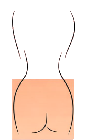 Square glute shape