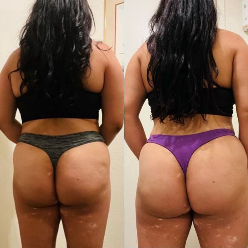 Natural booty building