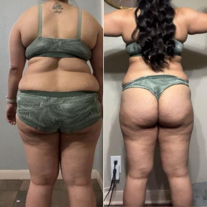 Glute transformation progress