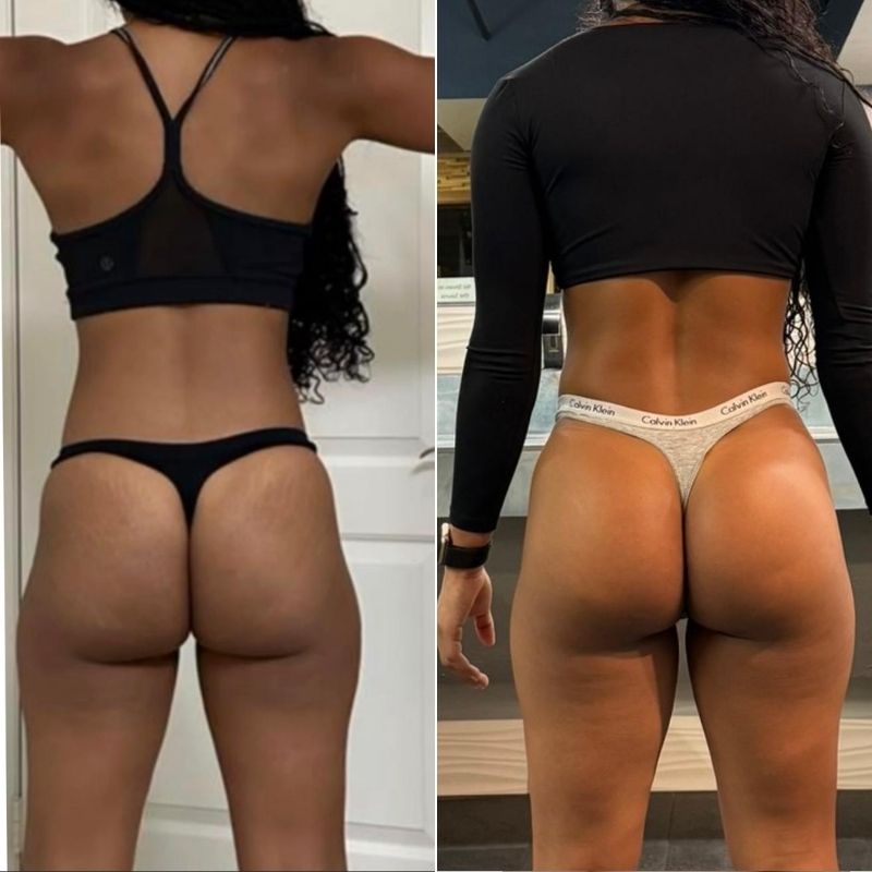 Before and after glute growth
