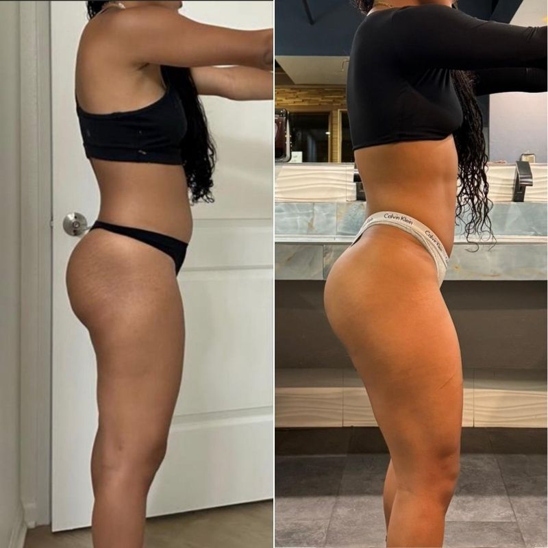 Natural glute transformation